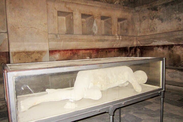 Plaster cast